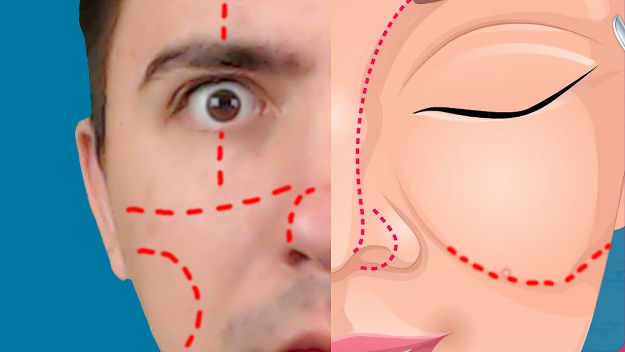 SDELAL-OPERATSIYU-PO-SMENE-LITSA-IGRY-DLYA-DETEJ-42