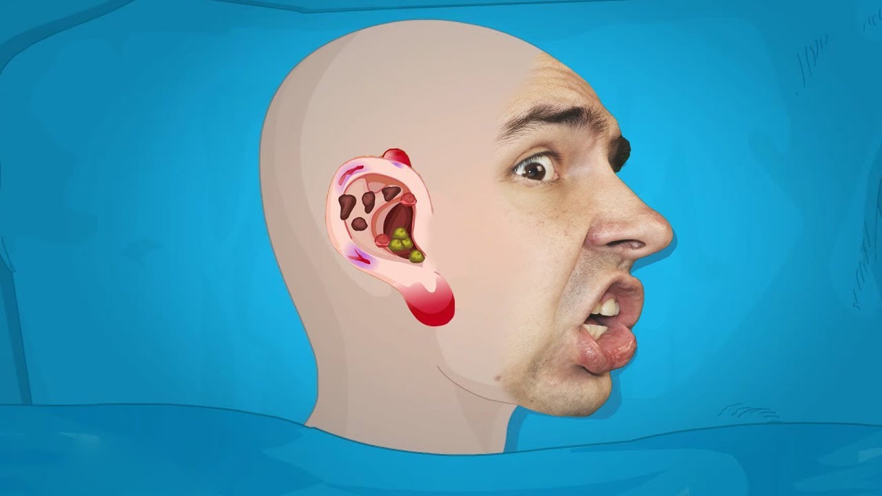 OPERATSIYA-NA-UHE-Ear-surgery